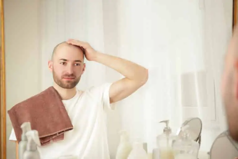 Hair loss concept
