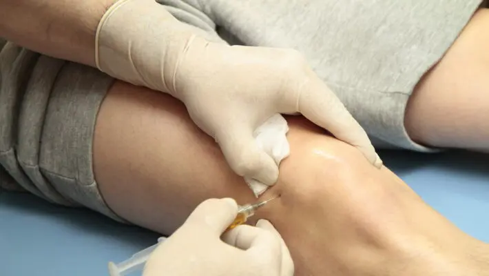Platelet,Rich,Plasma,Prp,Used,In,Treatment,Of,Knee,Injuries