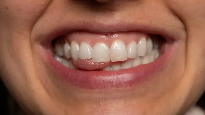 Are you unhappy with your gummy smile? Do you feel self-conscious about the appearance of your teeth because your gums are too prominent or uneven?