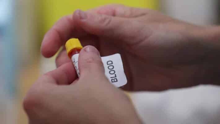 Antibody test