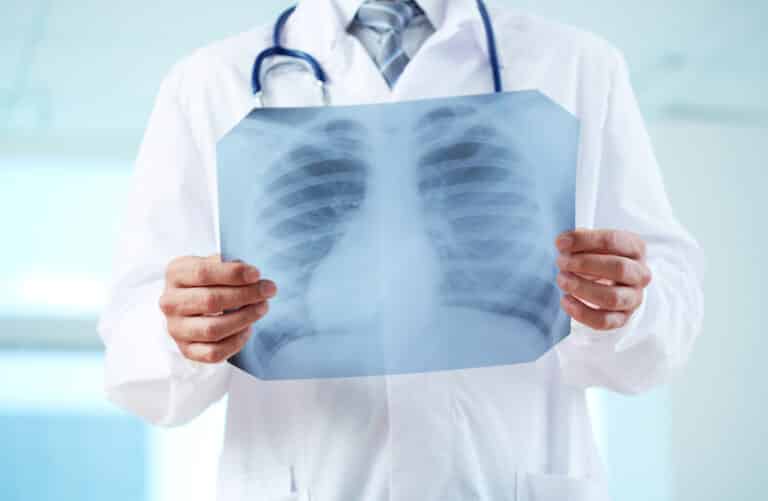 Doctor with x-ray