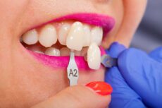 A beautiful smile can enhance your confidence and leave a lasting impression. Porcelain veneers offer a fantastic solution if you want to transform your smile.